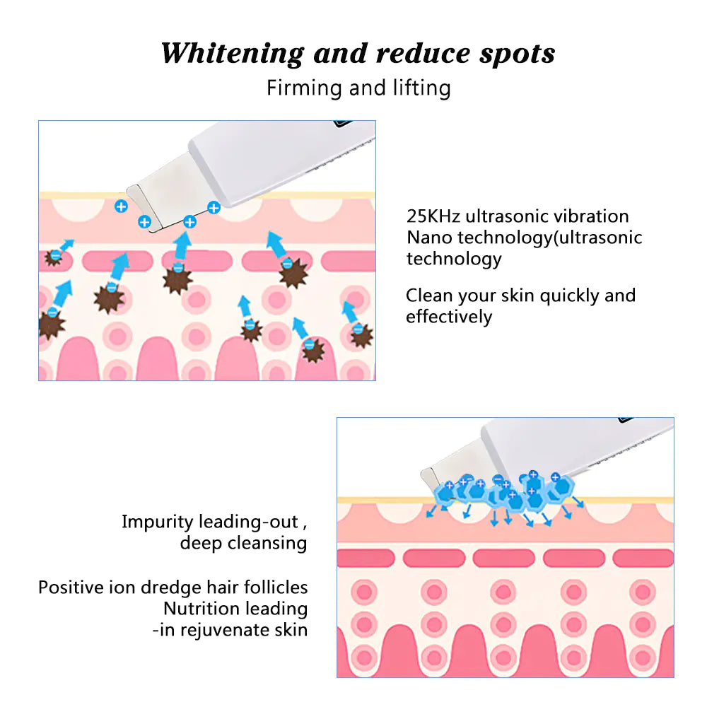 The GlowUp Pro: 4-in-1 Ultrasonic Facial Scrubber &amp; Deep Cleanser